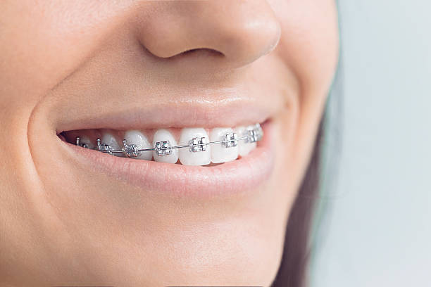 Best Invisalign and Clear Aligners  in Morton, TX